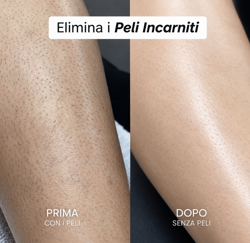 Essenza Silk ®